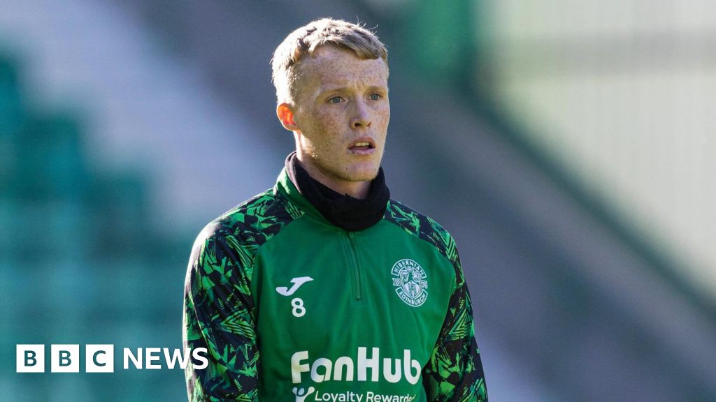 O ex -jogador do Hibs processa o clube por treinar lesões por gerente