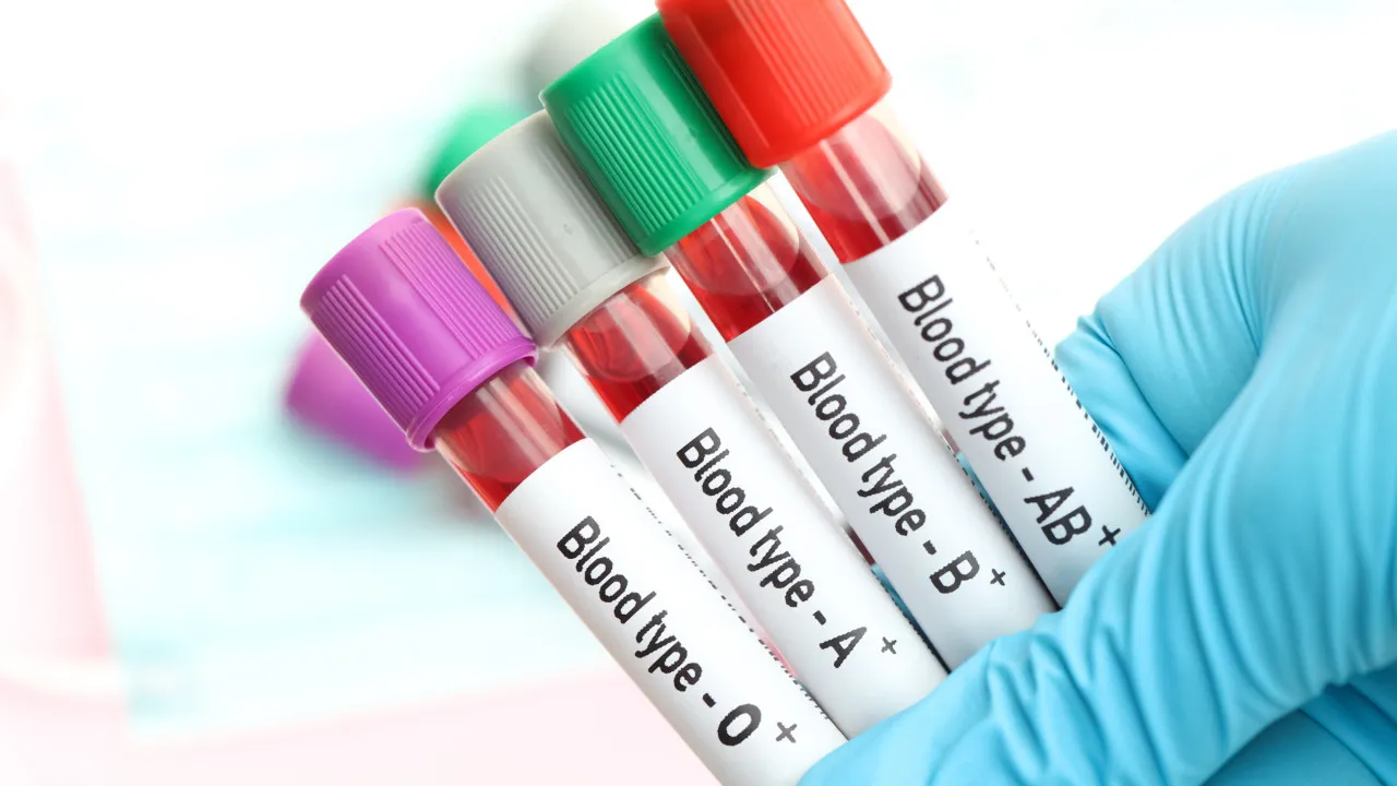 Tipo de Sangue e Risco de AVC: Estudo Revela Ligaça Surpreendendende