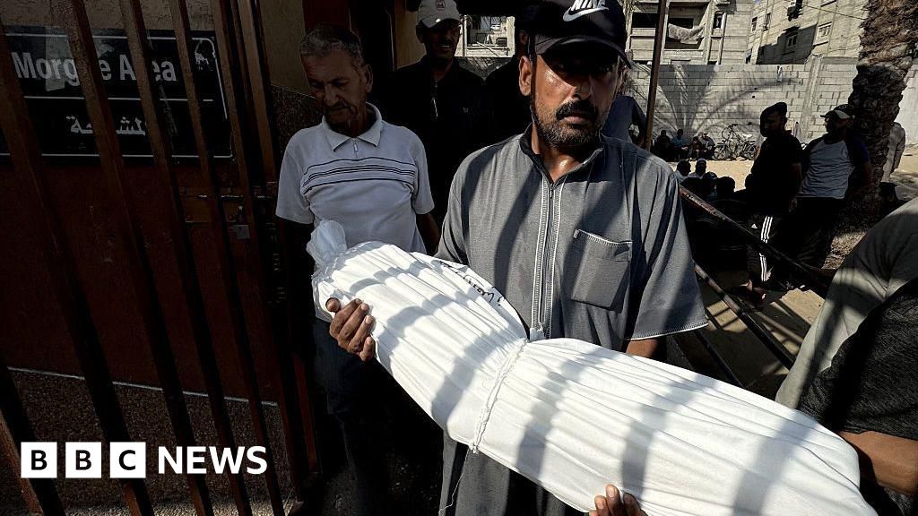 O Ministério da Saúde de Gaza diz que 33 pessoas morreram de desnutrição em 48 horas