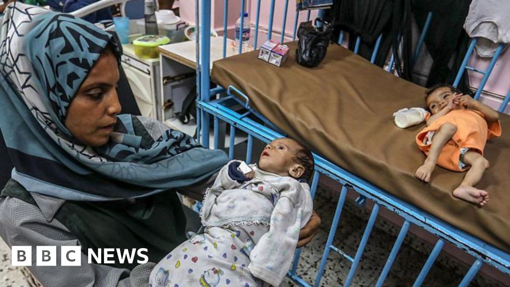 Uma em cada cinco crianças em Gaza está desnutrida, diz a agência de ajuda da ONU